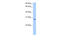 Nuclear Receptor Interacting Protein 3 antibody, 30-643, ProSci, Western Blot image 