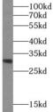 Asparaginase Like 1 antibody, FNab00648, FineTest, Western Blot image 