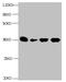 Insulin Like Growth Factor Binding Protein 1 antibody, CSB-MA088331A0m, Cusabio, Western Blot image 