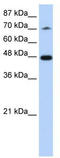 Splicing Factor 3b Subunit 4 antibody, TA345931, Origene, Western Blot image 