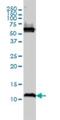 ATP Synthase Inhibitory Factor Subunit 1 antibody, H00093974-M01, Novus Biologicals, Western Blot image 