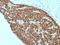 Caudal Type Homeobox 2 antibody, M00877, Boster Biological Technology, Immunohistochemistry paraffin image 