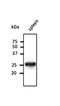 RAB5A, Member RAS Oncogene Family antibody, orb153348, Biorbyt, Western Blot image 