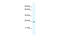 General Transcription Factor IIF Subunit 2 antibody, 27-343, ProSci, Western Blot image 