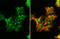 Androgen Receptor antibody, GTX635842, GeneTex, Immunocytochemistry image 