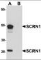Secernin 1 antibody, orb94557, Biorbyt, Western Blot image 