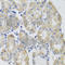 Glutamic--Pyruvic Transaminase antibody, A2814, ABclonal Technology, Immunohistochemistry paraffin image 