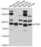 Integrin Subunit Beta 5 antibody, A2497, ABclonal Technology, Western Blot image 