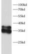 CD74 Molecule antibody, FNab10345, FineTest, Western Blot image 