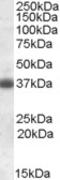 Clusterin antibody, EB08920, Everest Biotech, Western Blot image 