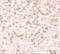 C-C Motif Chemokine Ligand 17 antibody, A02036, Boster Biological Technology, Immunohistochemistry frozen image 