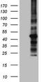 Serine/threonine-protein kinase mTOR antibody, CF805930, Origene, Western Blot image 