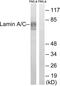 Lamin A/C antibody, LS-C118383, Lifespan Biosciences, Western Blot image 