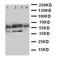 Parathyroid Hormone 1 Receptor antibody, LS-C313515, Lifespan Biosciences, Western Blot image 