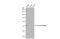 Ferrochelatase antibody, GTX113435, GeneTex, Western Blot image 