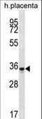 Olfactory Receptor Family 6 Subfamily K Member 6 antibody, LS-C158497, Lifespan Biosciences, Western Blot image 