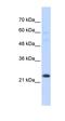TATA-Box Binding Protein Associated Factor 12 antibody, orb333131, Biorbyt, Western Blot image 