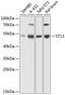 ST13 Hsp70 Interacting Protein antibody, 23-595, ProSci, Western Blot image 