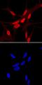 Homeobox B13 antibody, AF8156, R&D Systems, Immunocytochemistry image 