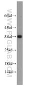 Emerin antibody, 10351-1-AP, Proteintech Group, Western Blot image 