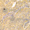 Interleukin 1 Receptor Type 2 antibody, A1899, ABclonal Technology, Immunohistochemistry paraffin image 