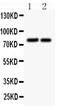Junction Plakoglobin antibody, PA1117-1, Boster Biological Technology, Western Blot image 