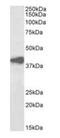 Alcohol Dehydrogenase 1A (Class I), Alpha Polypeptide antibody, orb372986, Biorbyt, Western Blot image 