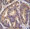 GTF2H2 Family Member C, Copy 2 antibody, LS-C166727, Lifespan Biosciences, Immunohistochemistry paraffin image 