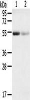 Solute Carrier Family 17 Member 1 antibody, TA351718, Origene, Western Blot image 