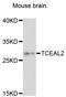 Transcription Elongation Factor A Like 2 antibody, LS-C748243, Lifespan Biosciences, Western Blot image 