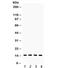 Fatty Acid Binding Protein 4 antibody, R31970, NSJ Bioreagents, Western Blot image 