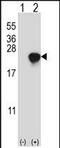 ADP Ribosylation Factor Like GTPase 2 antibody, PA5-72356, Invitrogen Antibodies, Western Blot image 