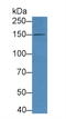 Nitric Oxide Synthase 3 antibody, LS-C297454, Lifespan Biosciences, Western Blot image 