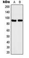 Solute Carrier Family 4 Member 1 Adaptor Protein antibody, orb224080, Biorbyt, Western Blot image 