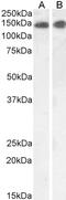 Leptin Receptor antibody, 45-084, ProSci, Western Blot image 