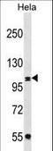 Coatomer Protein Complex Subunit Beta 1 antibody, LS-C159392, Lifespan Biosciences, Western Blot image 