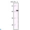 Keratin 5 antibody, LS-C812436, Lifespan Biosciences, Immunohistochemistry paraffin image 