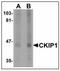 Pleckstrin Homology Domain Containing O1 antibody, AP23907PU-N, Origene, Western Blot image 