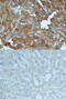 Serum Amyloid A1 antibody, AF2948, R&D Systems, Immunohistochemistry paraffin image 