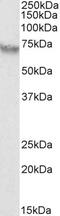 VRK Serine/Threonine Kinase 2 antibody, 43-551, ProSci, Western Blot image 