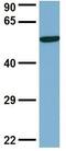 Dynactin Subunit 4 antibody, GTX45016, GeneTex, Western Blot image 