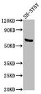 Pyruvate Dehyrogenase Phosphatase Catalytic Subunit 1 antibody, LS-C673929, Lifespan Biosciences, Western Blot image 