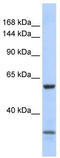 Zinc Finger Protein 777 antibody, TA345177, Origene, Western Blot image 