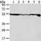 DExD-Box Helicase 39B antibody, PA5-50854, Invitrogen Antibodies, Western Blot image 