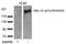 ABL Proto-Oncogene 1, Non-Receptor Tyrosine Kinase antibody, AP08038PU-N, Origene, Western Blot image 