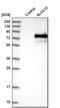 Arachidonate 15-lipoxygenase antibody, NBP1-90336, Novus Biologicals, Western Blot image 