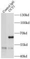 Chaperonin Containing TCP1 Subunit 3 antibody, FNab01397, FineTest, Immunoprecipitation image 