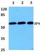 Zona Pellucida Glycoprotein 4 antibody, PA5-37086, Invitrogen Antibodies, Western Blot image 