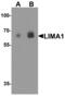 LIM Domain And Actin Binding 1 antibody, MBS153425, MyBioSource, Western Blot image 