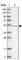 CTD Small Phosphatase 2 antibody, HPA027317, Atlas Antibodies, Western Blot image 